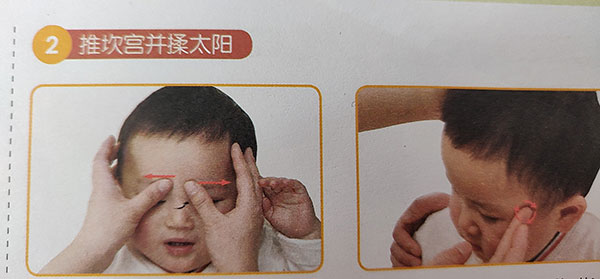 小儿推拿推拿处方感冒